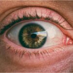 Catarata em idosos: sinais, cirurgia e recuperação, olho catarata, cirurgia oftalmológica