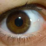 Olhos vermelhos em idosos: causas, sinais de alerta e quando procurar ajuda