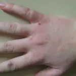 Pele seca em idosos: causas, cuidados e sinais de alerta