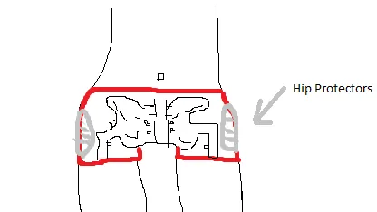 Diagrama mostra onde ficam as almofadas de um protetor de quadril usado por baixo da roupa íntima