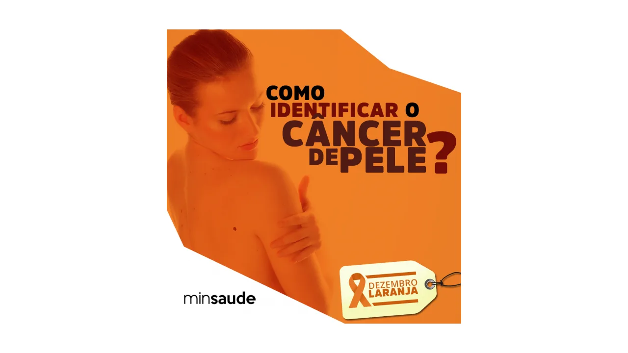 Material do Ministério da Saúde explica como identificar sinais do câncer de pele