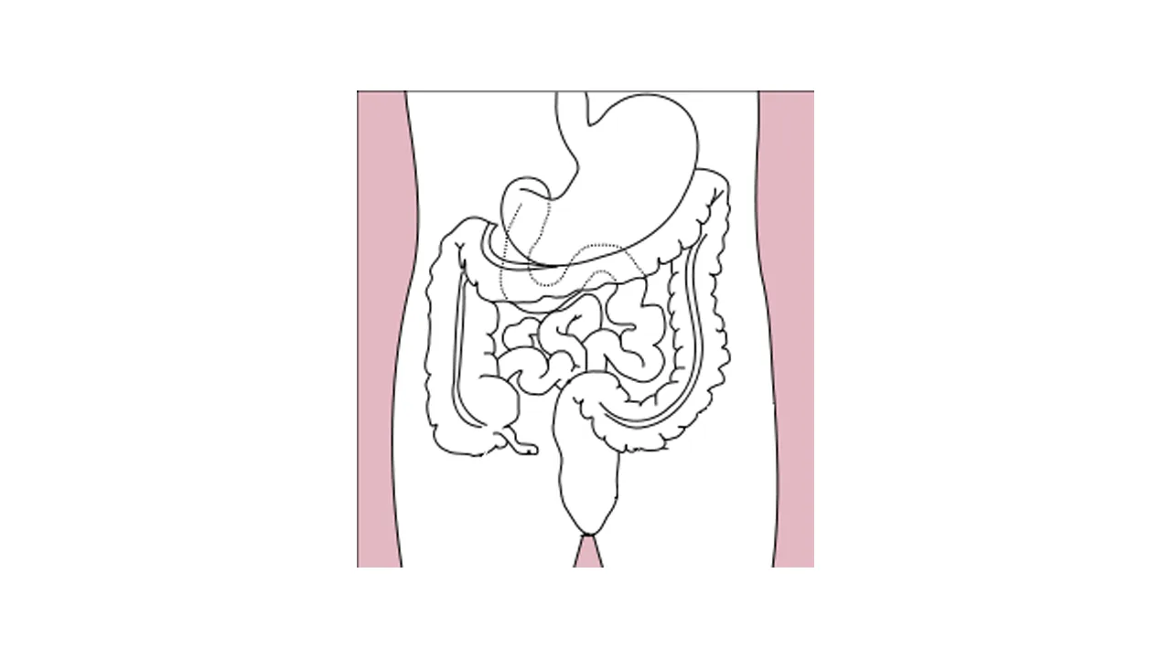 Esquema do estômago e do intestino, onde os gases podem se acumular