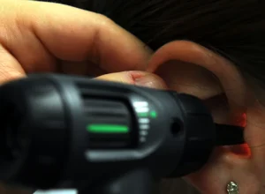 Profissional examinando o ouvido de uma pessoa com um otoscópio